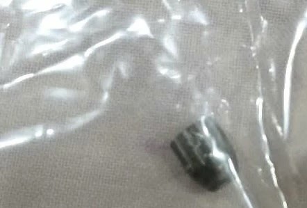 Đầu đạn được lấy ra từ người nạn nhân