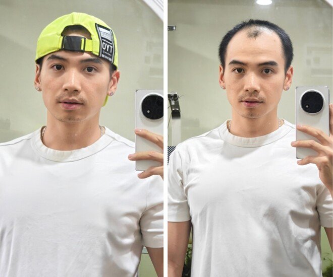 Chồng H&#39;Hen Niê đi đâu cũng được hỏi "đã mọc tóc chưa", hiện nổi tiếng hơn cả vợ Hoa hậu - 5