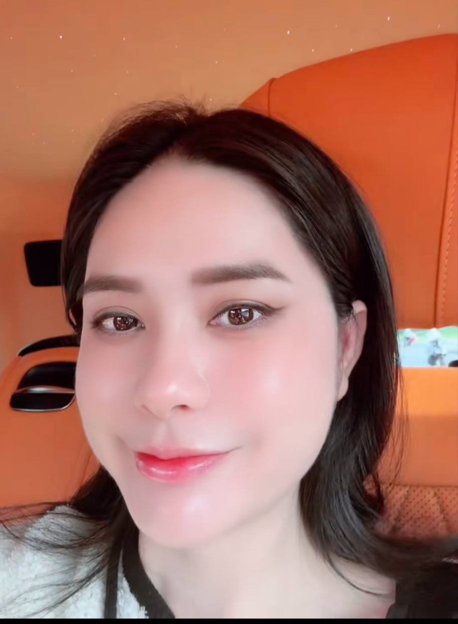 Đoàn Di Băng quảng cáo sản phẩm vừa bị thu hồi là mặt nạ tế bào gốc, đắp 10 phút giảm ngay 80% vết thương - 4