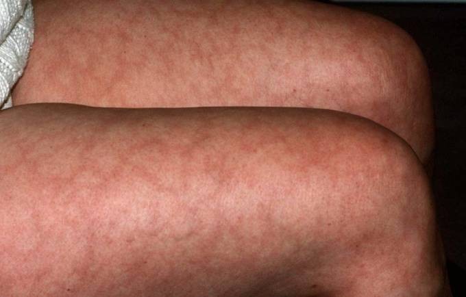 Ảnh 5: Texan Vein &amp; Vascular