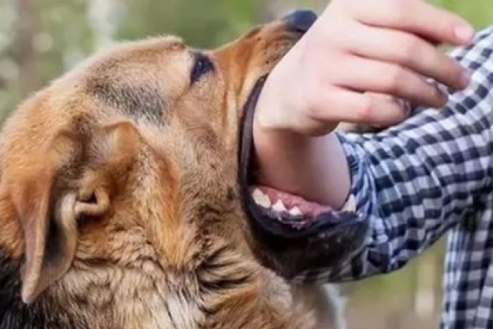 Sau 5 tháng bị chó nhà cắn, em bé 8 tuổi nguy kịch, tiên lượng tử vong