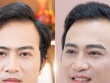 Cả showbiz Việt phun 'chân mày phong thủy cải vận'