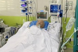 7 người nhập viện cấp cứu vì say nắng, có ca nguy kịch, phải thở máy