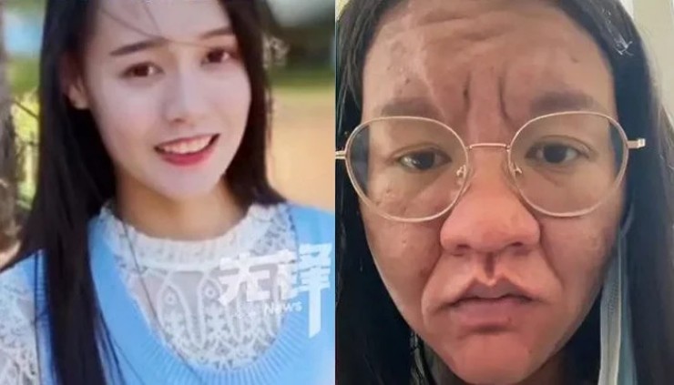 Li Wei trước và sau khi mang thai.