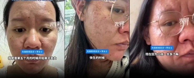 Ngoại hình của cô thay đổi đáng kể từ tháng thứ 5.