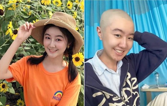 Cao Quân Vũ chia sẻ video điều trị bệnh u não khiến nhiều người thương cảm.