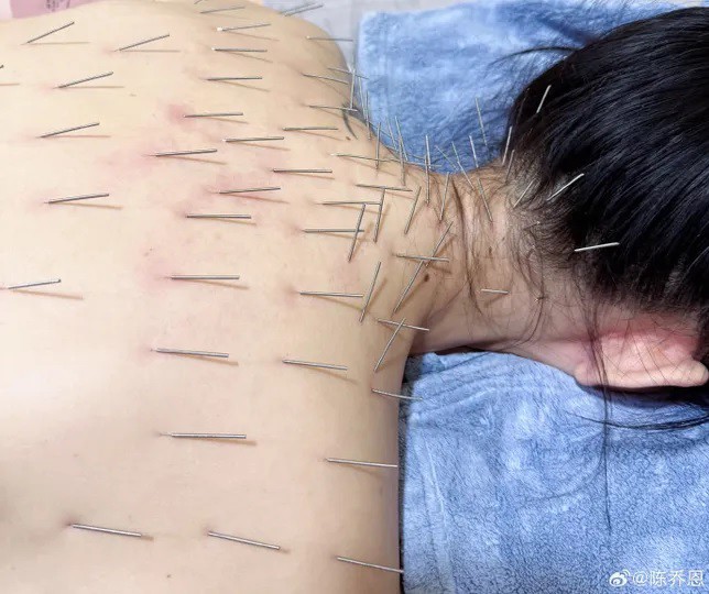 Trần Kiều Ân gây tranh cãi với phương pháp làm đẹp đau đớn - 2