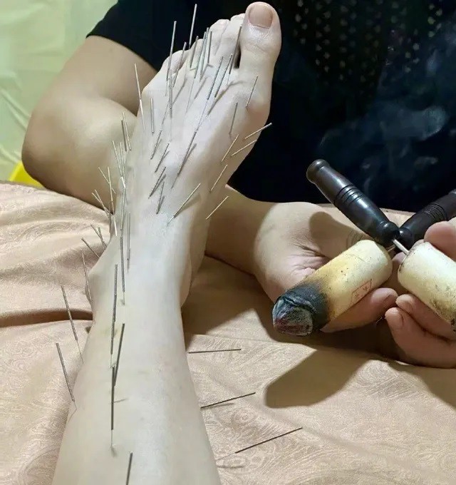 Nữ diễn viên cho biết quá trình điều trị rất đau đớn.