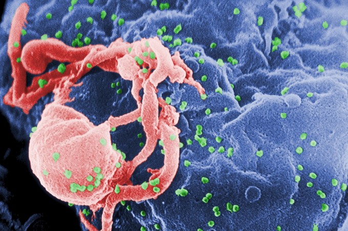 Ảnh hiển vi điện tử quét cho thấy HIV-1 (màu xanh) đang nảy chồi từ tế bào lympho được nuôi cấy. Ảnh: CDC