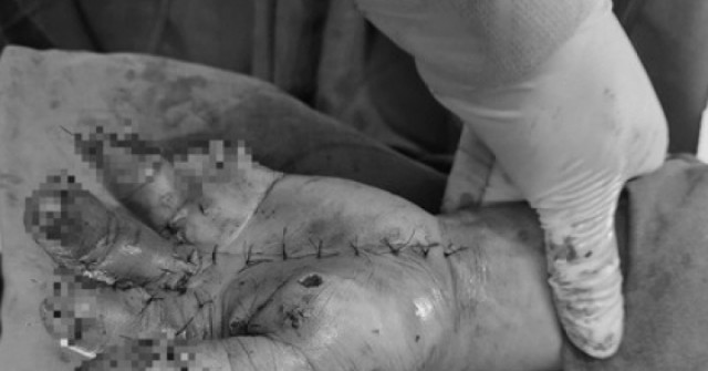 Người đàn ông nhập viện khẩn do thói quen dùng điện thoại nhiều người hay mắc phải