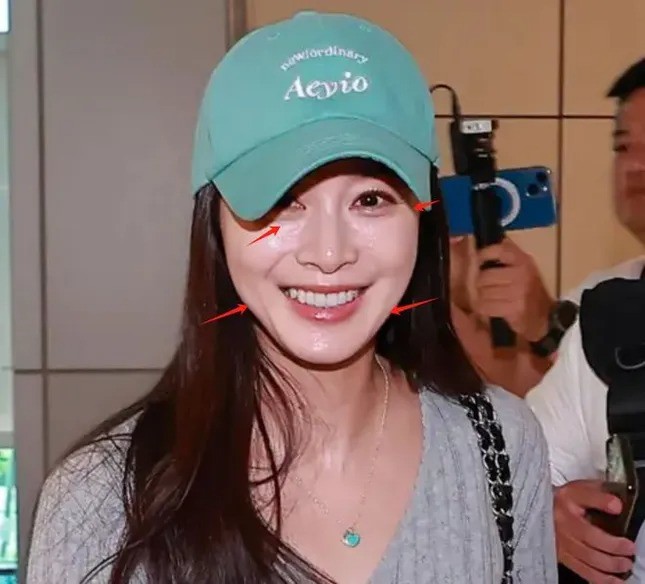 Kim Tae Hee gây tranh cãi - 1