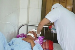 Cánh quạt máy bay không người lái chém gãy xương mũi người đi đường