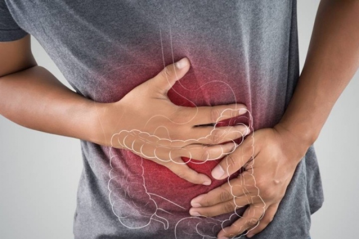 Ung thư đại tràng ở người trẻ: Những lầm tưởng khiến bệnh phát hiện quá muộn