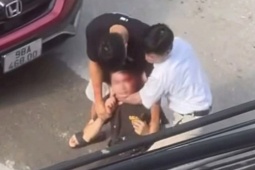 Nam thanh niên bị chảy máu đầu sau câu nói  " mày biết tao là ai không "  của người đi ô tô