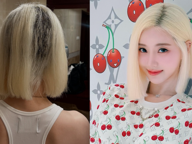 DJ Hàn trụi cả mảng tóc vì sự cố làm đẹp