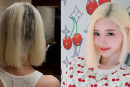 DJ Hàn trụi cả mảng tóc vì sự cố làm đẹp