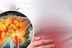 6 cách ngăn ngừa và kiểm soát bệnh gan nhiễm mỡ an toàn và hiệu quả