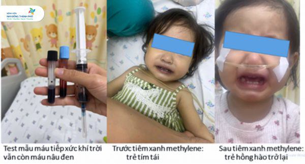 Các bác sĩ đã giúp cứu sống trẻ sau khi điều trị giải độc với xanh methylene tiêm mạch. Ảnh: BVCC