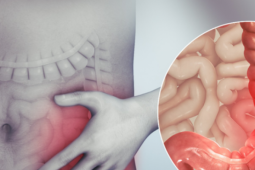 Người đàn ông 67 tuổi ở Hà Nội phát hiện ung thư đại tràng thừa nhận chủ quan với dấu hiệu báo bệnh này