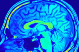 Các nhà khoa học tìm cách giải mã nguồn sáng liên tục phát trong bộ não người