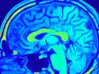 Các nhà khoa học tìm cách giải mã nguồn sáng liên tục phát trong bộ não người