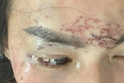 Diễn biến nóng vụ người phụ nữ ở Cà Mau bị cắt tóc, xăm mặt