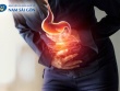 Cảnh báo viêm loét dạ dày – tá tràng: Nhận biết sớm để điều trị kịp thời, tránh biến chứng