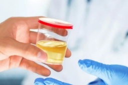7 triệu chứng ban đầu của bệnh gan thường bị bỏ qua