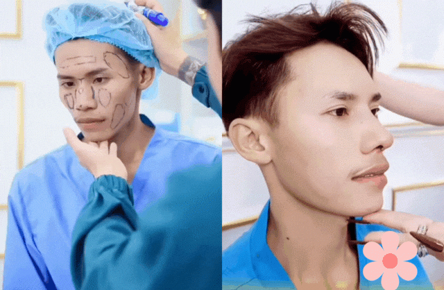 Lai Thai đã sửa chiếc mũi to, gồ ghề và bị quặp xuống của mình sang dáng L-line.