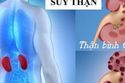 7 việc nên làm để phòng nguy cơ suy thận