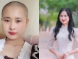 Cú sốc của những người trẻ mắc ung thư
