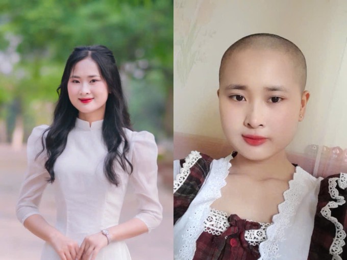 Thùy Dung, 19 tuổi, ở Nghệ An trước và sau khi mắc ung thư xương. Ảnh: Nhân vật cung cấp