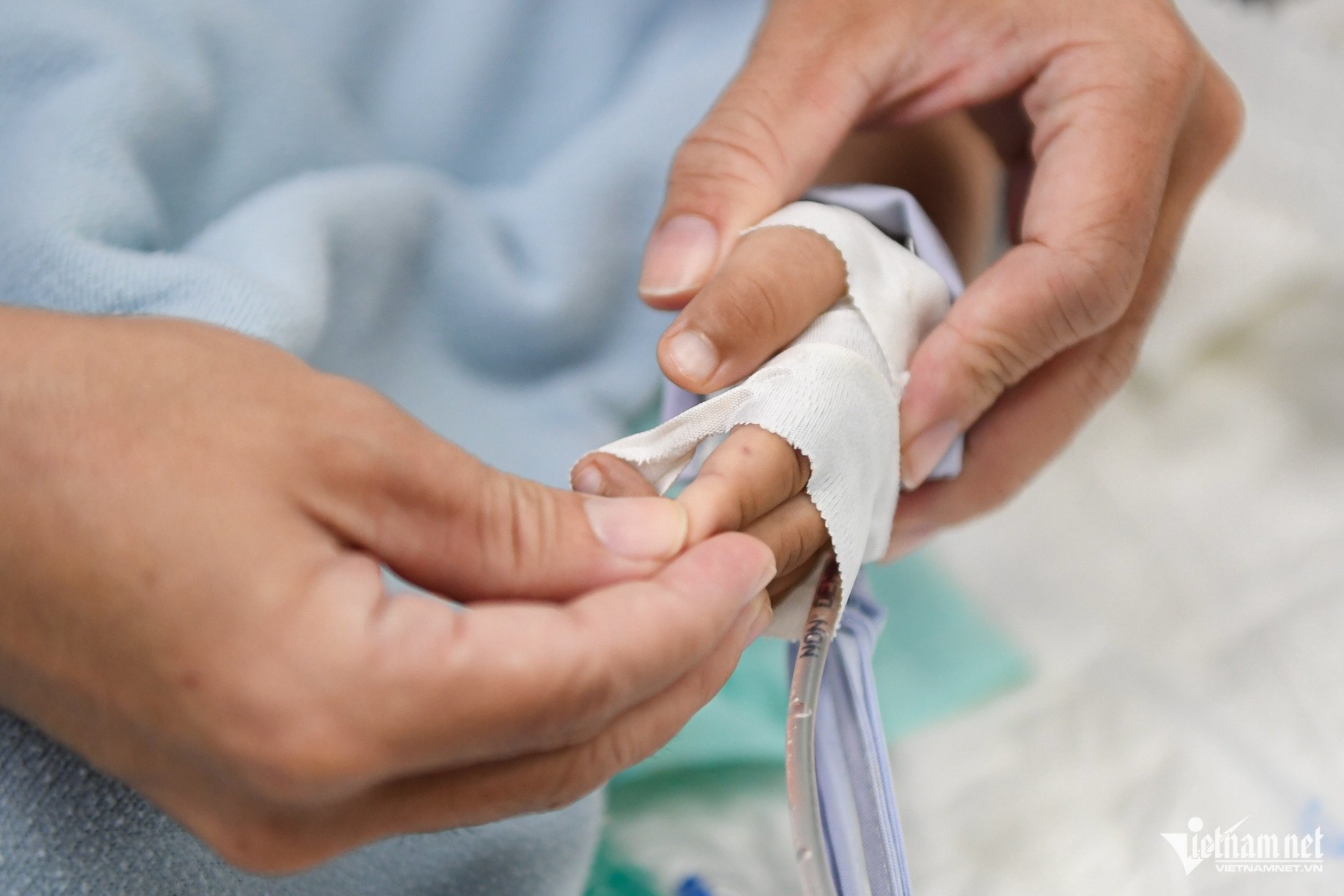 48 giờ mắc tay chân miệng, trẻ ngưng thở, lọc máu khẩn ở bệnh viện tuyến cuối - 2