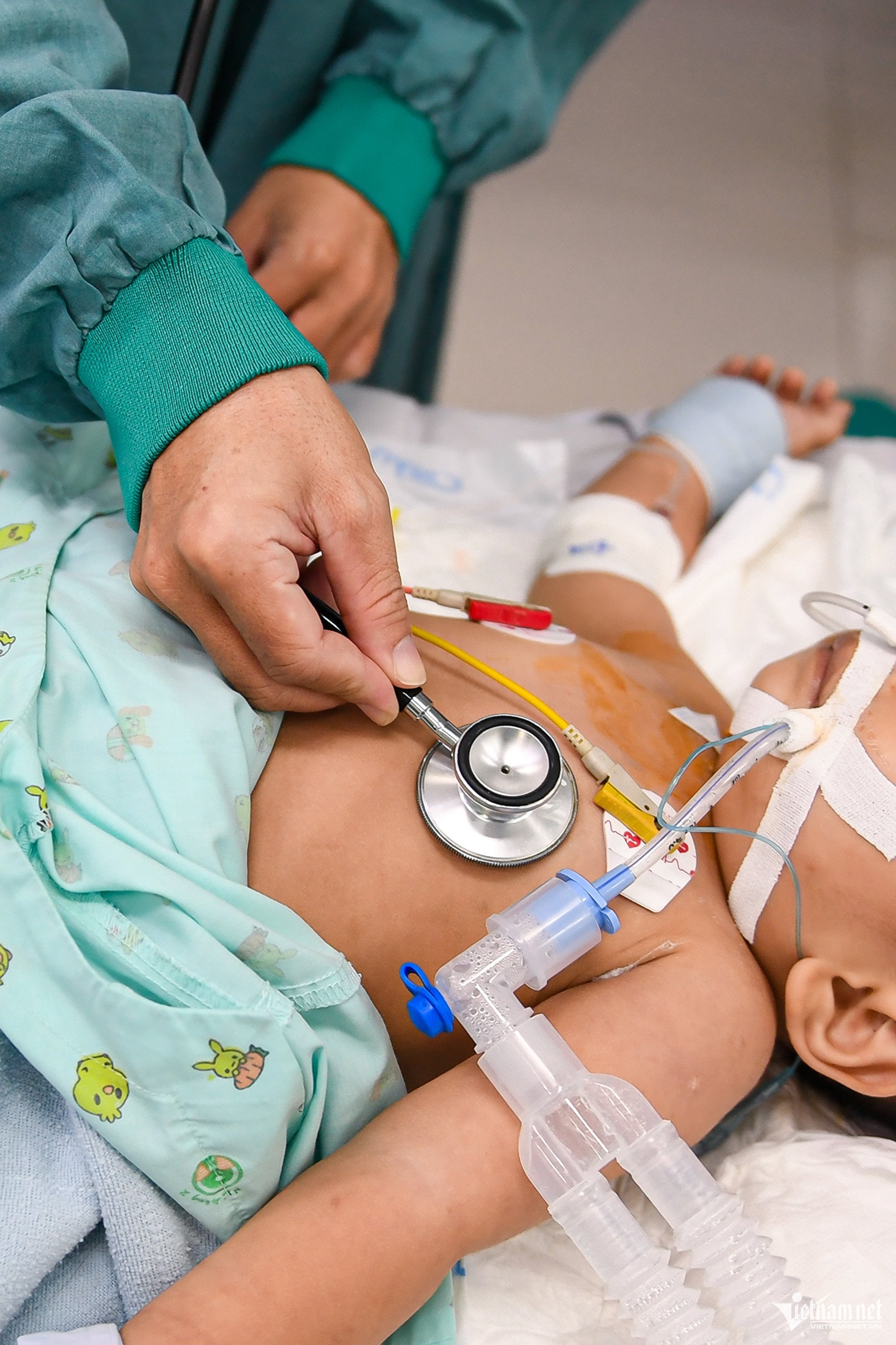 48 giờ mắc tay chân miệng, trẻ ngưng thở, lọc máu khẩn ở bệnh viện tuyến cuối - 3