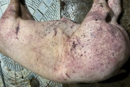 Thông tin về công ty đưa thịt lợn bệnh vào trường học tại Hà Nội