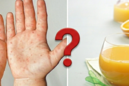 Nước cam tốt nhưng trẻ tay chân miệng nên tránh: Chuyên gia giải thích lý do