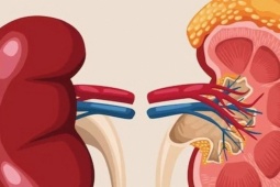 6 loại quả đang bán đầy chợ Việt, người bệnh suy thận nên ăn để kiểm soát bệnh, ngăn ngừa biến chứng