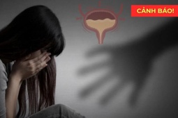 Tin tức sức khỏe - Cảnh báo: Đây mới là “sát thủ giấu mặt” khiến bạn tiểu nhiều, không phải do “thận yếu”!
