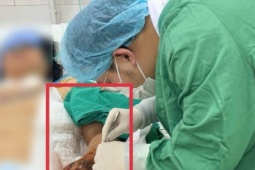 Người phụ nữ 52 tuổi ở Bắc Ninh sốc nhiễm khuẩn, suy đa tạng chỉ từ một tổn thương nhỏ mà nhiều người Việt rất hay bỏ qua