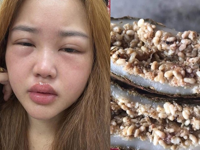 Thưởng thức bánh trứng kiến đang hot: Người khen ngon, người nhập viện vì sốc phản vệ