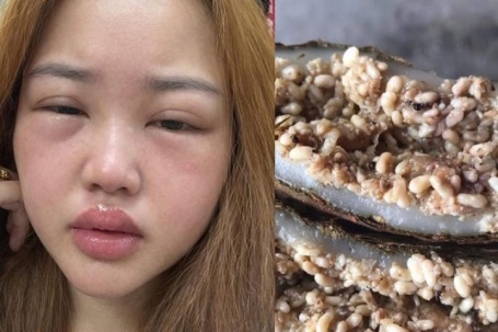 Thưởng thức bánh trứng kiến đang hot: Người khen ngon, người nhập viện vì sốc phản vệ