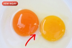 Tin tức sức khỏe - 4 món ăn quen thuộc “nuôi lớn” tuyến tiền liệt từng ngày – nhiều nam giới vẫn vô tư ăn mỗi ngày