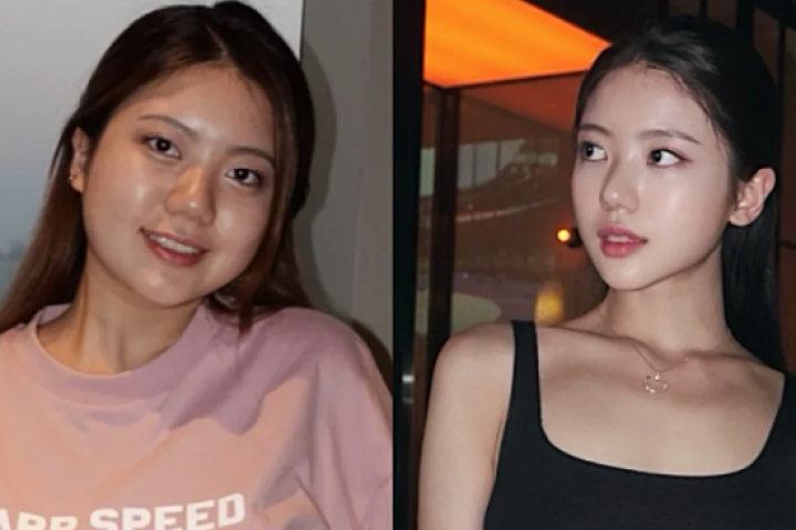 Giảm 18 kg sau 3 tháng nhờ ăn theo quy tắc 2:1:1