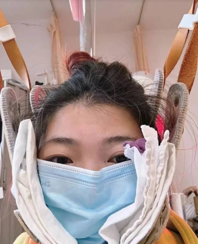 Hình thức kéo giãn cổ bằng phương pháp này hiện gây khá nhiều tranh cãi. Ảnh: Weibo