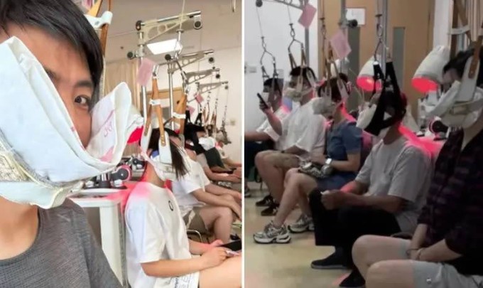 Nhiều người trẻ đổ đến viện để thực hiện bài tập "treo cổ" hay "kéo giãn cổ" vì muốn giảm thoái hóa, đau cổ vai gáy. Ảnh: Weibo