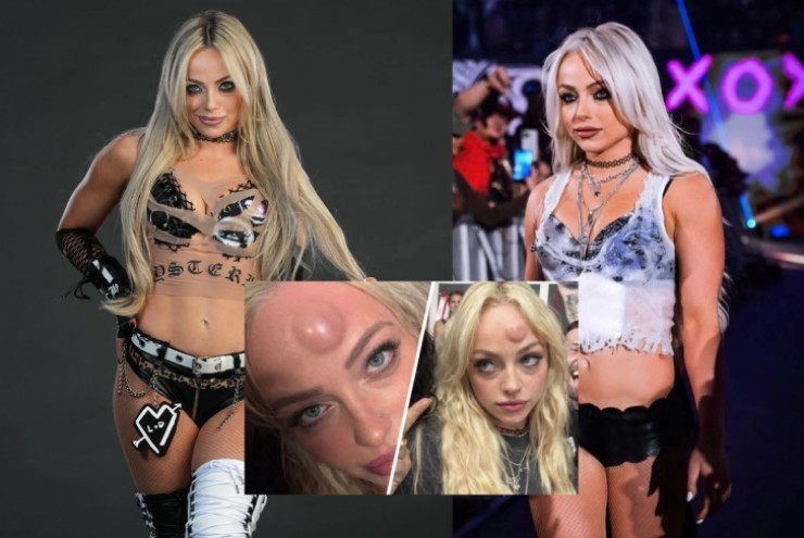 Mỹ nhân vật hết trận vẫn bị tấn công đáng sợ: Vỡ đầu, chấn động não