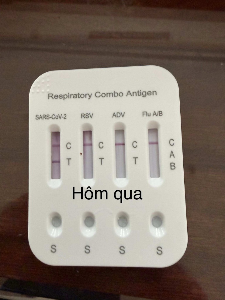 Tuấn Hưng mắc Covid-19, Dương Edward nhập viện cấp cứu - 1