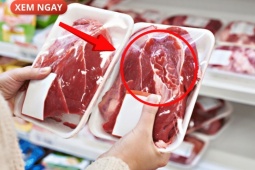 Tin tức sức khỏe - 5 loại thực phẩm cực hại cho tuyến tiền liệt của phái mạnh, nhiều người vẫn vô tư ăn mỗi ngày