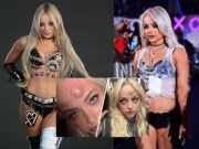 Mỹ nhân vật hết trận vẫn bị tấn công đáng sợ: Vỡ đầu, chấn động não