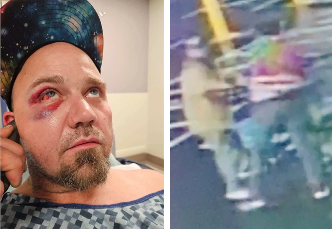 Joshua Merkel bị thương sau khi bị nhân viên siêu thị chặn lại, vung tay đấm vì đẩy xe chở hàng ra ngoài mà không trả tiền.